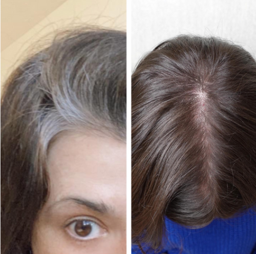 Sérum Anti-Cheveux Blancs Breveté