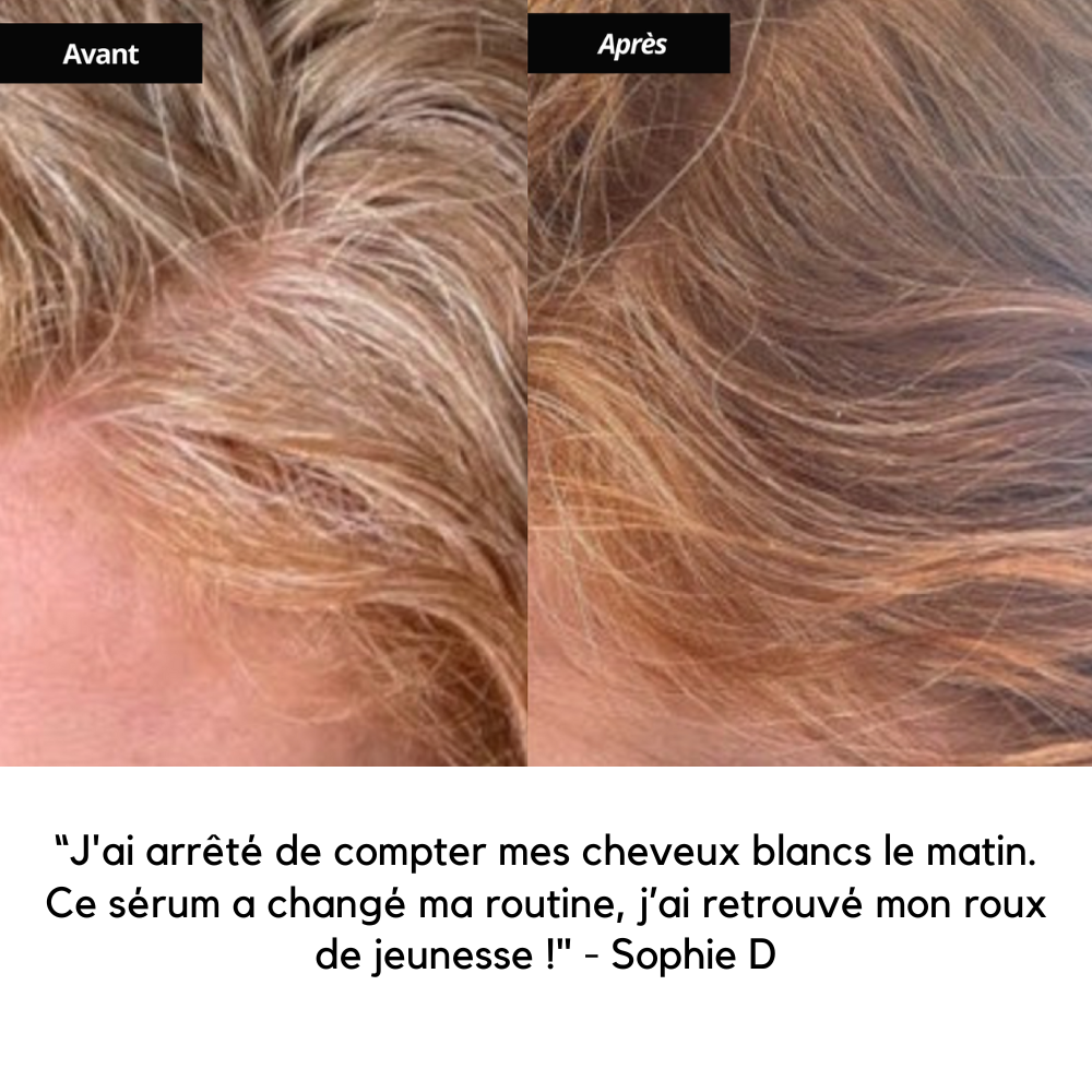 Sérum Anti-Cheveux Blancs Breveté