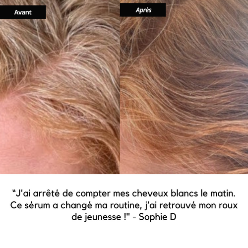 Sérum Anti-Cheveux Blancs Breveté